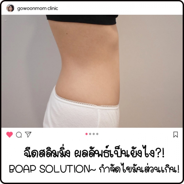 ฉีดสลิมมิ่ง ผลลัพธ์เป็นยังไง? BAOP SOLUTION~ กำจัดไขมันส่วนเกิน!